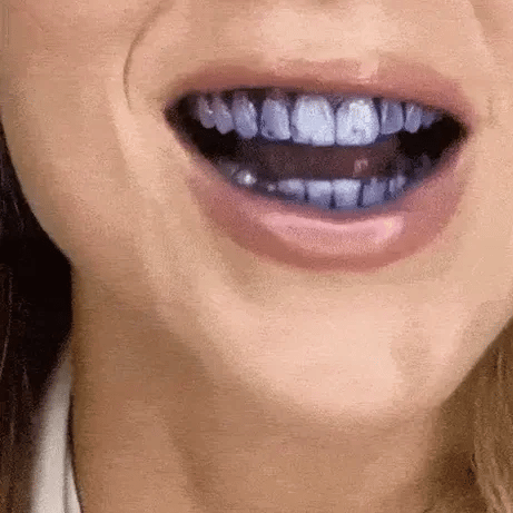 Teeth Brightening Hismile V34 Colour Corrector Serum